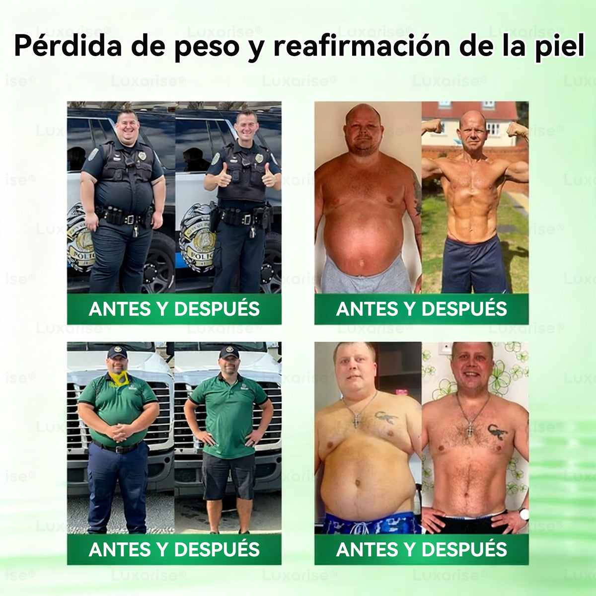 𝑻𝒊𝒆𝒏𝒅𝒂 𝑶𝒇𝒊𝒄𝒊𝒂𝒍  | 👩‍⚕️ 𝑳𝒖𝒙𝒂𝒓𝒊𝒔𝒆® 10 𝑬𝑵 1 𝑴𝒐𝒓𝒊𝒏𝒈𝒂 𝒀 𝑩𝒆𝒓𝒃𝒆𝒓𝒊𝒏𝒂 𝑷𝒂𝒓𝒄𝒉𝒆 𝑨𝒗𝒂𝒏𝒛𝒂𝒅𝒐 𝑫𝒆 𝑴𝒊𝒄𝒓𝒐𝒏𝒆𝒆𝒅𝒍𝒆𝒔 𝑵𝒂𝒏𝒐（𝑼𝒏𝒂 𝒗𝒆𝒛 𝒂𝒍 𝒅í𝒂, 𝒄𝒂𝒎𝒃𝒊𝒐𝒔 𝒗𝒊𝒔𝒊𝒃𝒍𝒆𝒔 𝒆𝒏 7 𝒅í𝒂𝒔） ✅ 𝑶𝒃𝒆𝒔𝒊𝒅𝒂𝒅, 𝑫𝒊𝒂𝒃𝒆𝒕𝒆𝒔, 𝑨𝒑𝒏𝒆𝒂 𝒅𝒆𝒍 𝑺𝒖𝒆ñ𝒐 𝒚 𝑷𝒓𝒐𝒃𝒍𝒆𝒎𝒂𝒔 𝑨𝒓𝒕𝒊𝒄𝒖𝒍𝒂𝒓𝒆𝒔  定  微针贴 正确版  美国西班牙