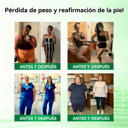 𝑻𝒊𝒆𝒏𝒅𝒂 𝑶𝒇𝒊𝒄𝒊𝒂𝒍  | 👩‍⚕️ 𝑳𝒖𝒙𝒂𝒓𝒊𝒔𝒆® 10 𝑬𝑵 1 𝑴𝒐𝒓𝒊𝒏𝒈𝒂 𝒀 𝑩𝒆𝒓𝒃𝒆𝒓𝒊𝒏𝒂 𝑷𝒂𝒓𝒄𝒉𝒆 𝑨𝒗𝒂𝒏𝒛𝒂𝒅𝒐 𝑫𝒆 𝑴𝒊𝒄𝒓𝒐𝒏𝒆𝒆𝒅𝒍𝒆𝒔 𝑵𝒂𝒏𝒐（𝑼𝒏𝒂 𝒗𝒆𝒛 𝒂𝒍 𝒅í𝒂, 𝒄𝒂𝒎𝒃𝒊𝒐𝒔 𝒗𝒊𝒔𝒊𝒃𝒍𝒆𝒔 𝒆𝒏 7 𝒅í𝒂𝒔） ✅ 𝑶𝒃𝒆𝒔𝒊𝒅𝒂𝒅, 𝑫𝒊𝒂𝒃𝒆𝒕𝒆𝒔, 𝑨𝒑𝒏𝒆𝒂 𝒅𝒆𝒍 𝑺𝒖𝒆ñ𝒐 𝒚 𝑷𝒓𝒐𝒃𝒍𝒆𝒎𝒂𝒔 𝑨𝒓𝒕𝒊𝒄𝒖𝒍𝒂𝒓𝒆𝒔  定  微针贴 正确版  美国西班牙