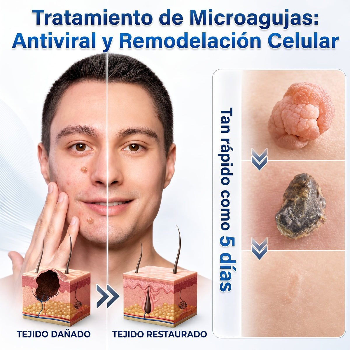 👩‍⚕️🥇𝑻𝒊𝒆𝒏𝒅𝒂 𝑶𝒇𝒊𝒄𝒊𝒂𝒍 | 𝑵𝐞𝒌𝐢𝐬𝐬® 🌿 𝑀𝑖𝑐𝑟𝑜𝑎𝑔𝑢𝑗𝑎𝑠 𝑃𝑖𝑒𝑙 𝐼𝑚𝑝𝑒𝑐𝑎𝑏𝑙𝑒 𝐸𝑙𝑖𝑚𝑖𝑛𝑎𝑐𝑖ó𝑛 𝐷𝑒 𝑉𝑒𝑟𝑟𝑢𝑔𝑎𝑠 𝑃𝑎𝑟𝑐ℎ𝑒 (𝑃𝑎𝑟𝑎 𝑎𝑐𝑟𝑜𝑐𝑜𝑟𝑑𝑜𝑛𝑒𝑠, 𝑝𝑒𝑞𝑢𝑒ñ𝑎𝑠 𝑖𝑚𝑝𝑒𝑟𝑓𝑒𝑐𝑐𝑖𝑜𝑛𝑒𝑠 𝑐𝑢𝑡á𝑛𝑒𝑎𝑠, 𝑣𝑒𝑟𝑟𝑢𝑔𝑎𝑠, 𝑙𝑢𝑛𝑎𝑟𝑒𝑠, 𝑚𝑎𝑛𝑐ℎ𝑎𝑠 𝑑𝑒 𝑙𝑎 𝑒𝑑𝑎𝑑 𝑦 𝑝𝑟𝑜𝑏𝑙𝑒𝑚𝑎𝑠 𝑑𝑒 𝑝𝑖𝑔𝑚𝑒𝑛𝑡𝑎𝑐𝑖ó𝑛.)