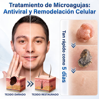 👩‍⚕️🥇𝑻𝒊𝒆𝒏𝒅𝒂 𝑶𝒇𝒊𝒄𝒊𝒂𝒍 | 𝑵𝐞𝒌𝐢𝐬𝐬® 🌿 𝑀𝑖𝑐𝑟𝑜𝑎𝑔𝑢𝑗𝑎𝑠 𝑃𝑖𝑒𝑙 𝐼𝑚𝑝𝑒𝑐𝑎𝑏𝑙𝑒 𝐸𝑙𝑖𝑚𝑖𝑛𝑎𝑐𝑖ó𝑛 𝐷𝑒 𝑉𝑒𝑟𝑟𝑢𝑔𝑎𝑠 𝑃𝑎𝑟𝑐ℎ𝑒 (𝑃𝑎𝑟𝑎 𝑎𝑐𝑟𝑜𝑐𝑜𝑟𝑑𝑜𝑛𝑒𝑠, 𝑝𝑒𝑞𝑢𝑒ñ𝑎𝑠 𝑖𝑚𝑝𝑒𝑟𝑓𝑒𝑐𝑐𝑖𝑜𝑛𝑒𝑠 𝑐𝑢𝑡á𝑛𝑒𝑎𝑠, 𝑣𝑒𝑟𝑟𝑢𝑔𝑎𝑠, 𝑙𝑢𝑛𝑎𝑟𝑒𝑠, 𝑚𝑎𝑛𝑐ℎ𝑎𝑠 𝑑𝑒 𝑙𝑎 𝑒𝑑𝑎𝑑 𝑦 𝑝𝑟𝑜𝑏𝑙𝑒𝑚𝑎𝑠 𝑑𝑒 𝑝𝑖𝑔𝑚𝑒𝑛𝑡𝑎𝑐𝑖ó𝑛.)