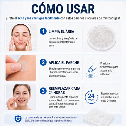 👩‍⚕️🥇𝑻𝒊𝒆𝒏𝒅𝒂 𝑶𝒇𝒊𝒄𝒊𝒂𝒍 | 𝑵𝐞𝒌𝐢𝐬𝐬® 🌿 𝑀𝑖𝑐𝑟𝑜𝑎𝑔𝑢𝑗𝑎𝑠 𝑃𝑖𝑒𝑙 𝐼𝑚𝑝𝑒𝑐𝑎𝑏𝑙𝑒 𝐸𝑙𝑖𝑚𝑖𝑛𝑎𝑐𝑖ó𝑛 𝐷𝑒 𝑉𝑒𝑟𝑟𝑢𝑔𝑎𝑠 𝑃𝑎𝑟𝑐ℎ𝑒 (𝑃𝑎𝑟𝑎 𝑎𝑐𝑟𝑜𝑐𝑜𝑟𝑑𝑜𝑛𝑒𝑠, 𝑝𝑒𝑞𝑢𝑒ñ𝑎𝑠 𝑖𝑚𝑝𝑒𝑟𝑓𝑒𝑐𝑐𝑖𝑜𝑛𝑒𝑠 𝑐𝑢𝑡á𝑛𝑒𝑎𝑠, 𝑣𝑒𝑟𝑟𝑢𝑔𝑎𝑠, 𝑙𝑢𝑛𝑎𝑟𝑒𝑠, 𝑚𝑎𝑛𝑐ℎ𝑎𝑠 𝑑𝑒 𝑙𝑎 𝑒𝑑𝑎𝑑 𝑦 𝑝𝑟𝑜𝑏𝑙𝑒𝑚𝑎𝑠 𝑑𝑒 𝑝𝑖𝑔𝑚𝑒𝑛𝑡𝑎𝑐𝑖ó𝑛.)
